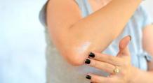 Causes of peeling skin on the elbows, stages and forms of treatment