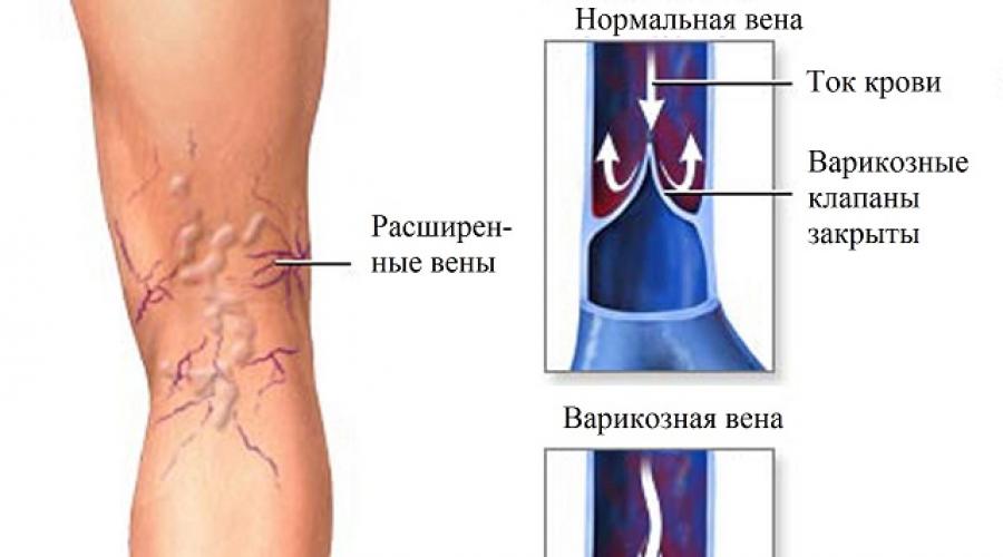 Почему Чешутся Ноги В Районе Щиколотки: Причины И Лечение