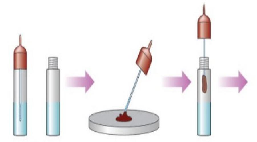 Скрытая кровь в кале тест для экспресс-анализатора. Как использовать экспресс-тест из аптеки для определения скрытой крови в кале? Ii. этап. непосредственно процедура тестирования