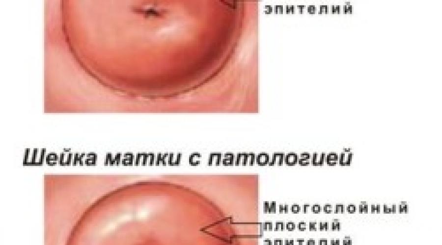 Строение женских наружных пол органов у женщин. Анатомическое строение женских половых органов
