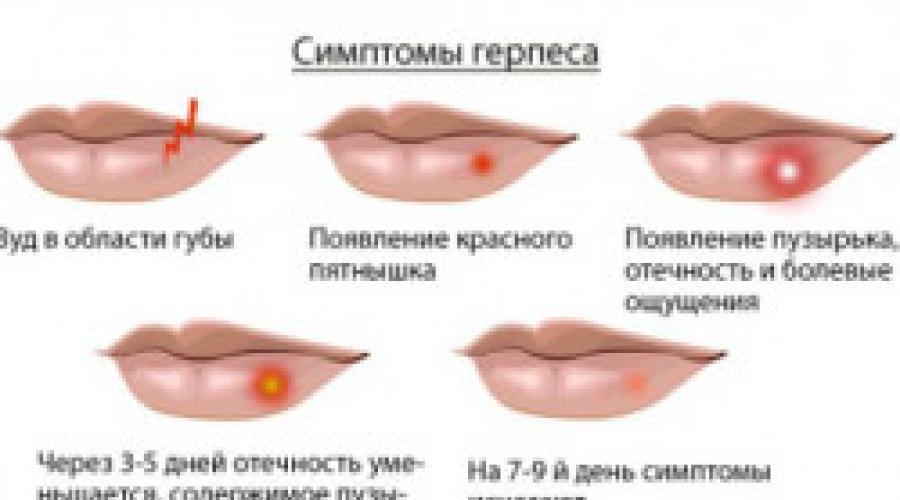 К чему чешится верхняя губа