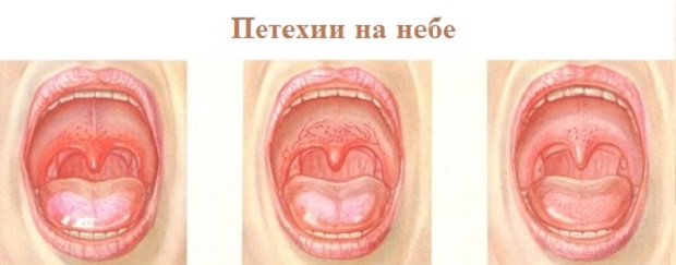Отдых в Адлере частная гостиница Эдем Отдых в Адлере частная гостиница Эдем