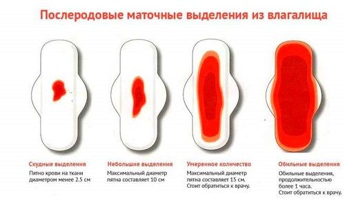Бело-желтые густые выделения. Желтоватые выделения выделения. Почему нет выделение у девушки. Вязкость цервикальной слизи. Женские выделения норма по дням цикла.