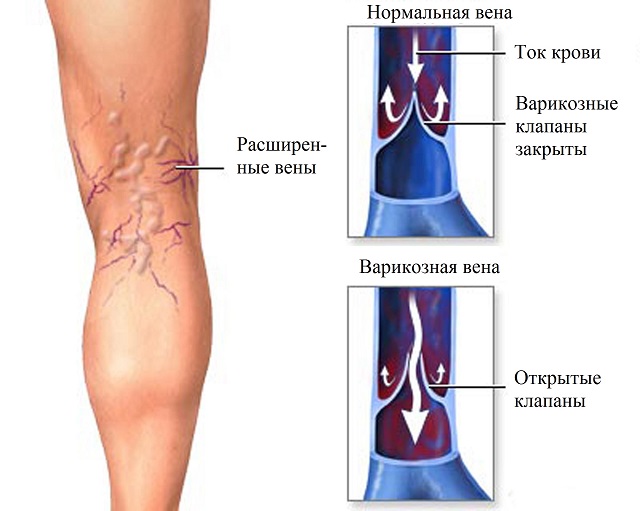 Prečo vás svrbia nohy v oblasti členkov: Príčiny a liečba
